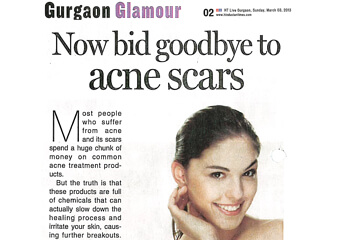 Now bid goodbye to acne scars