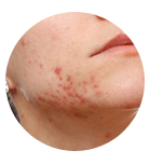 Skin Allergies