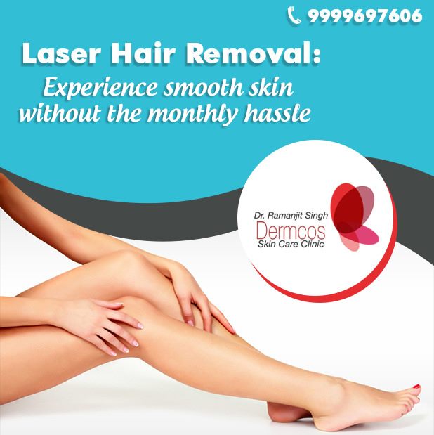 Safe Treatment for Permanent Hair Removal | Dermcos