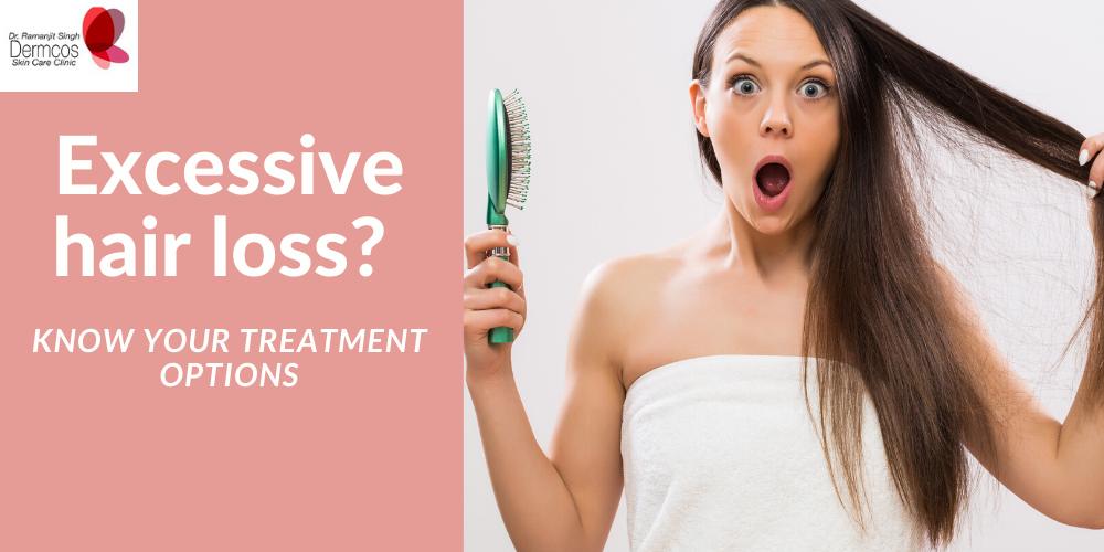 Excessive Hair Loss? Know Your Treatment Options - Dermcos | Dermcos