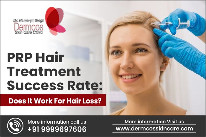 PRP Hair Treatment Success Rate | Dermcos