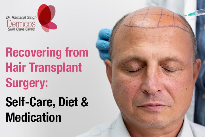 Recovering from Hair Transplant Surgery: Self-Care, Diet & Medication |  Dermcos