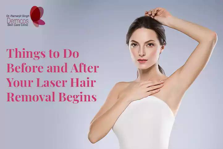Things to Do Before and After Your Laser Hair Removal Begins | Dermcos